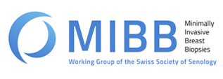 mibb
